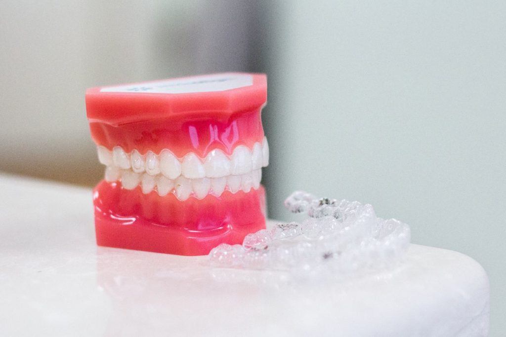 The Benefits of Choosing An Orthodontist Over Mail-Order Aligners
