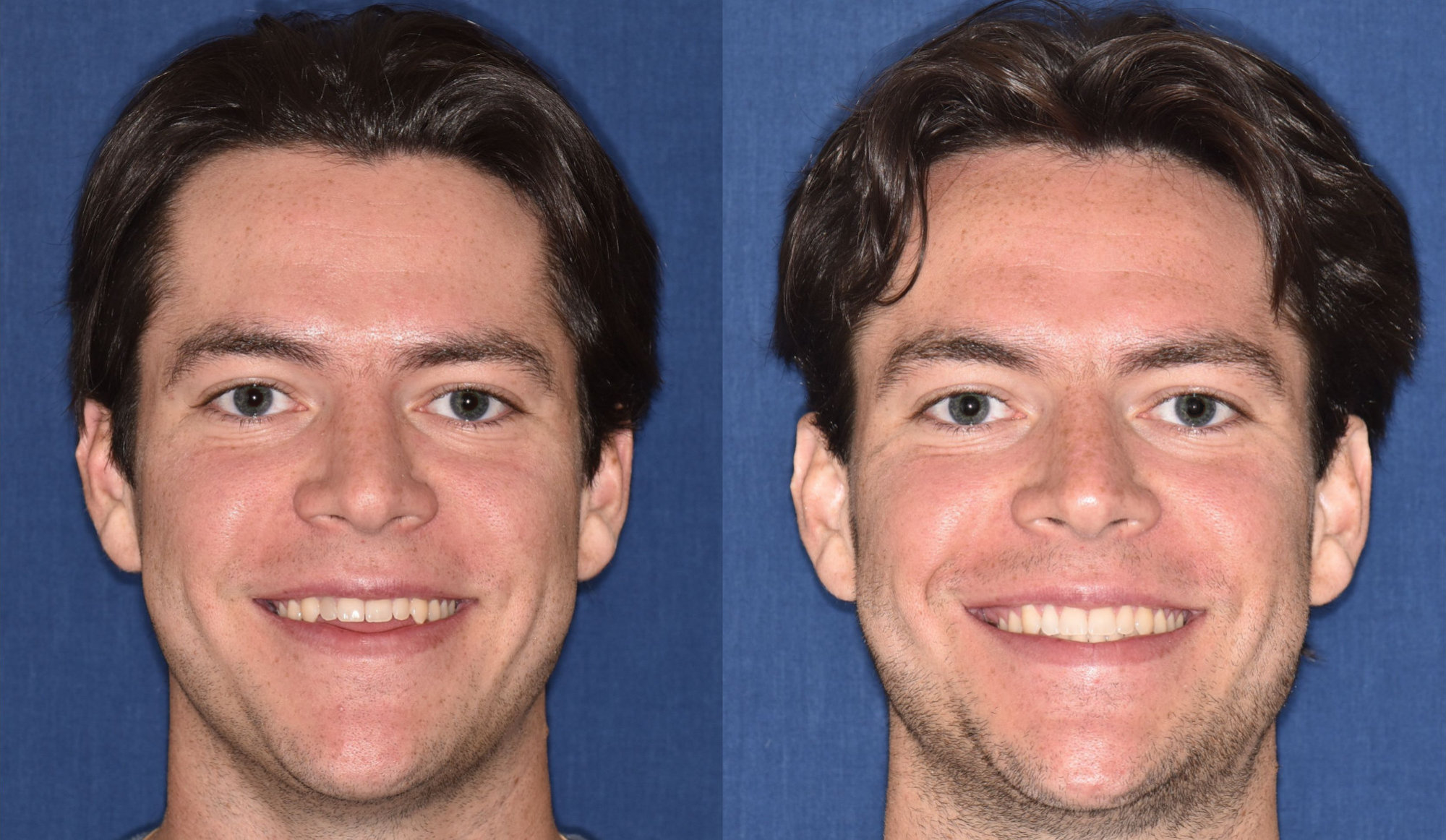 orthodontic office cedar rapids IA